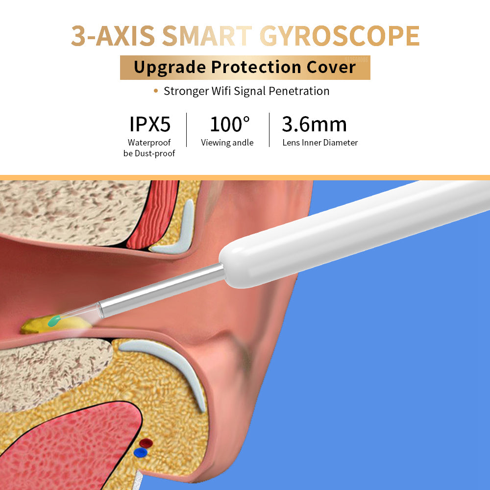 Ear Cleaner Otoscope - Ear Wax Removal Tool With Camera LED Light
