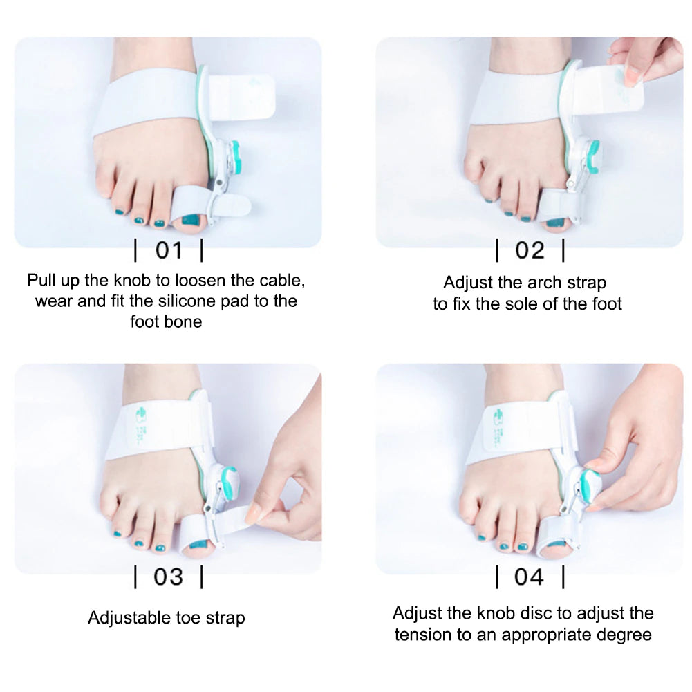 Hallux Valgus Bunion Corrector Orthotics Feet