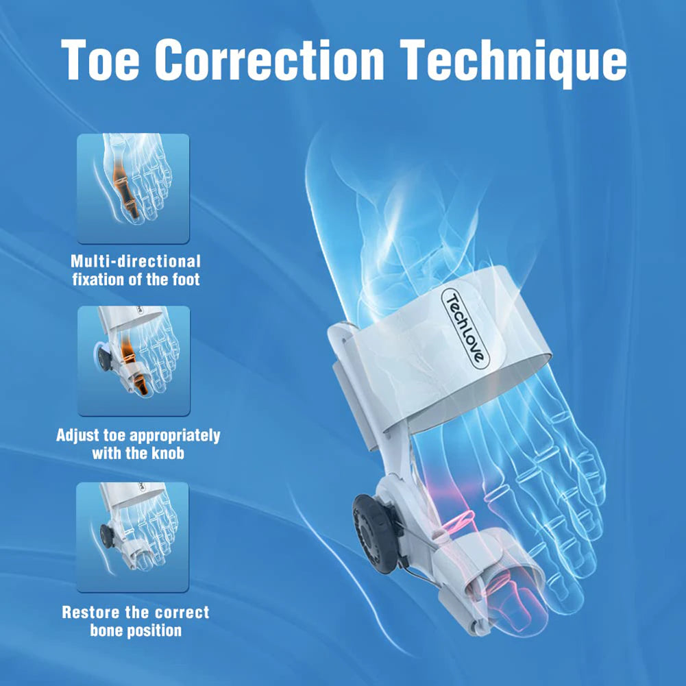 Hallux Valgus Bunion Corrector Orthotics Feet