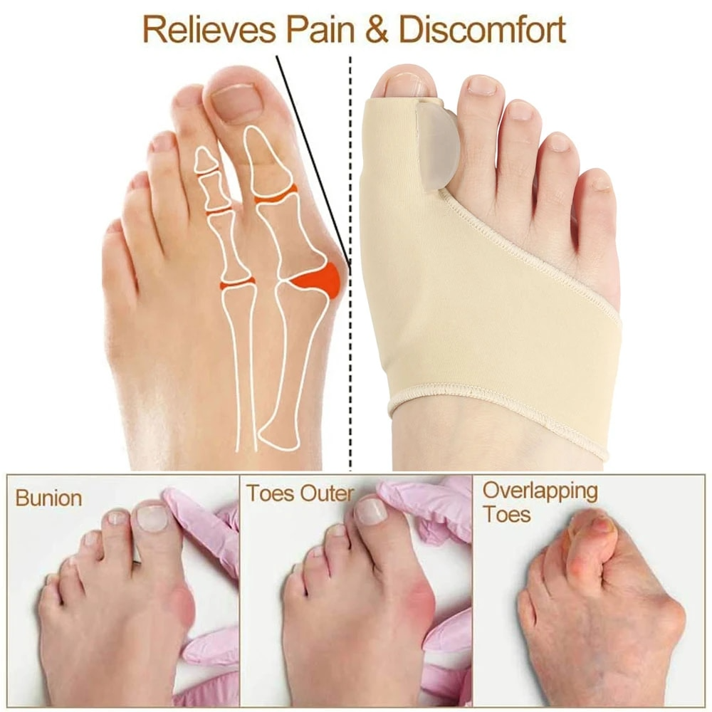 Hallux Valgus Bunion Corrector Orthotics Feet