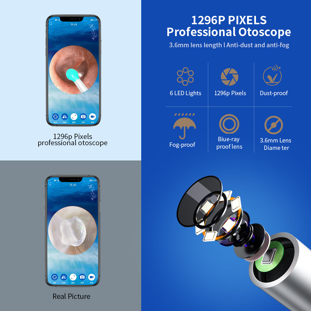 Ear Cleaner Otoscope - Ear Wax Removal Tool With Camera LED Light