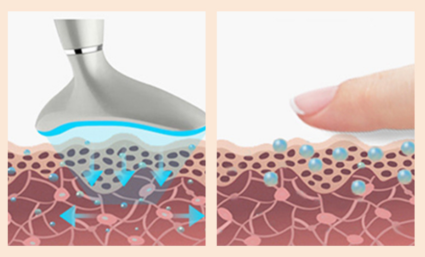 Neck Beauty Instrument To Remove Nasolabial Lines And Neck Lines Massage To Lift The Face