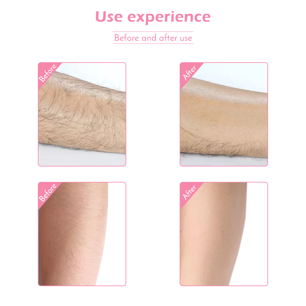 Hair Removal Waxing Kit At Home