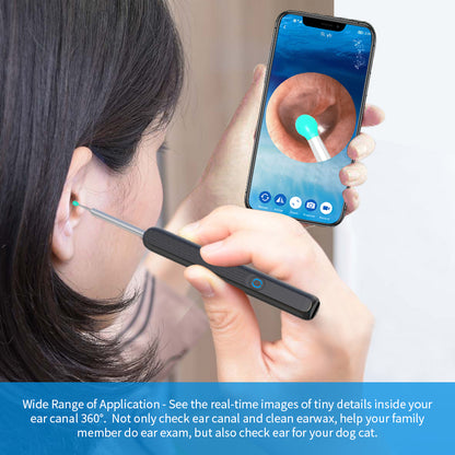 Ear Cleaner Otoscope - Ear Wax Removal Tool With Camera LED Light