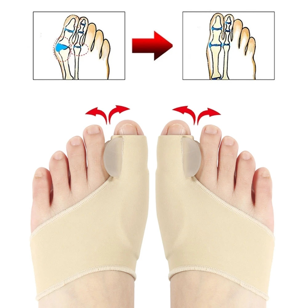 Hallux Valgus Bunion Corrector Orthotics Feet